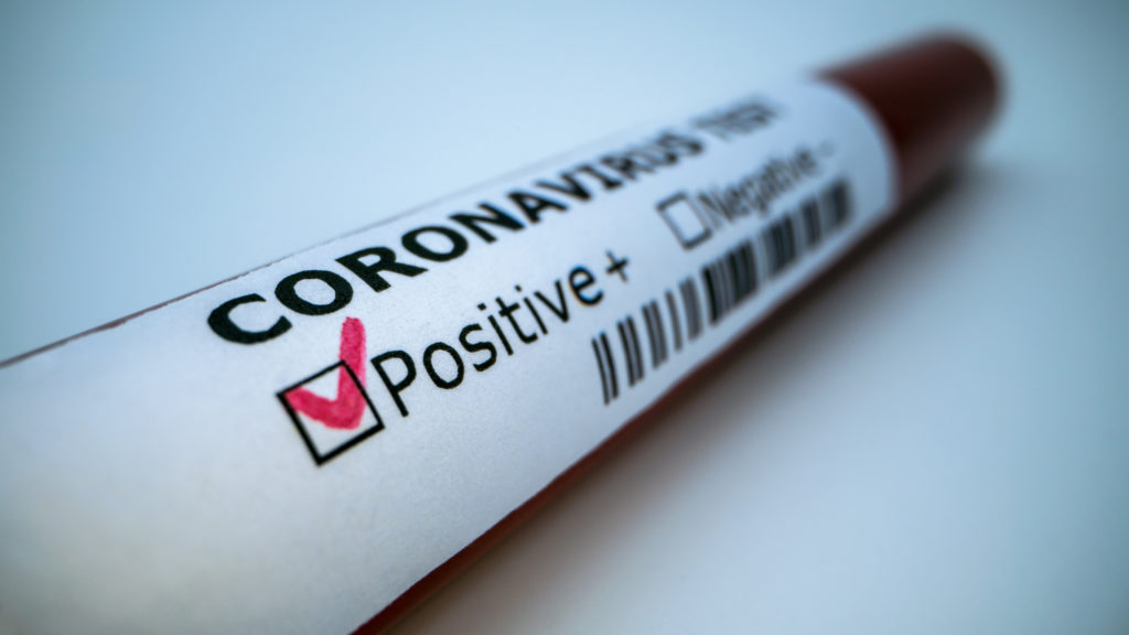 Stock image of positive coronavirus testing sample